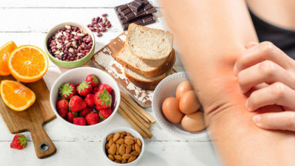 Mi az élelmiszer-allergia? Ki kap élelmiszer-allergiát, és milyen tünetei vannak?