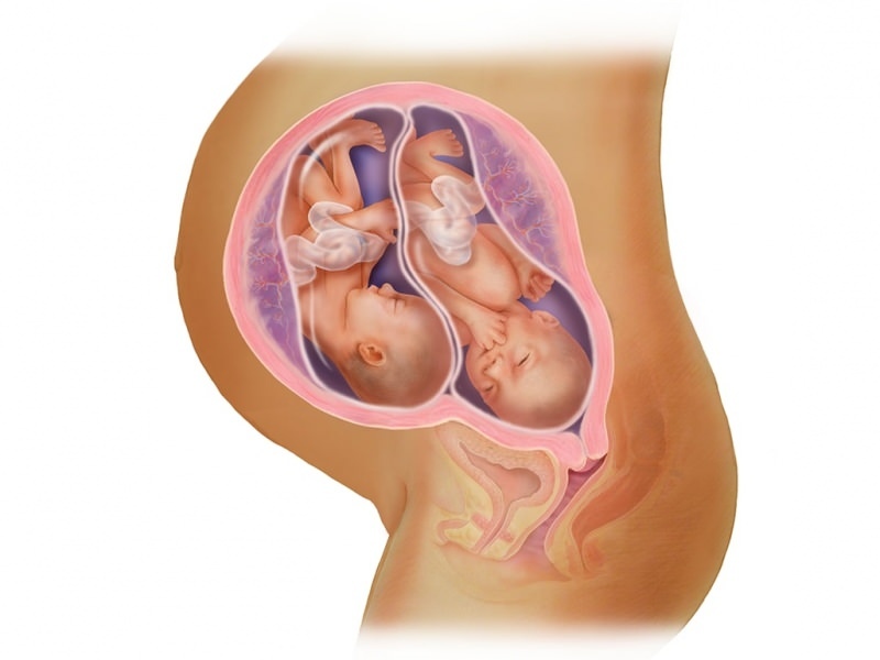 Iker terhesség IVF-ben! Mi az embrió transzfer?