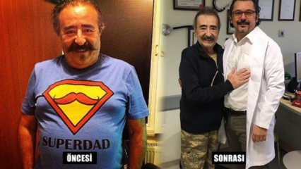 Yıldırım Öcek, aki gyomorműtétet végzett, meghalt