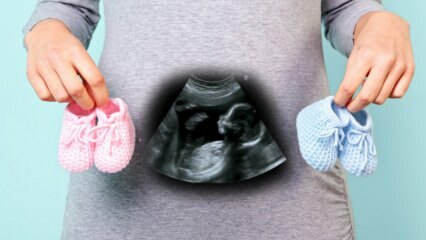 Meghatározzák-e a baba nemét a terhesség első trimeszterében?