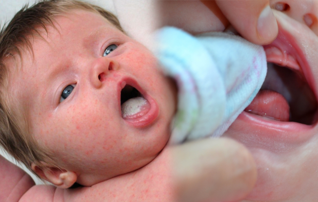 Hogy vannak a csecsemők szájfekélyei
