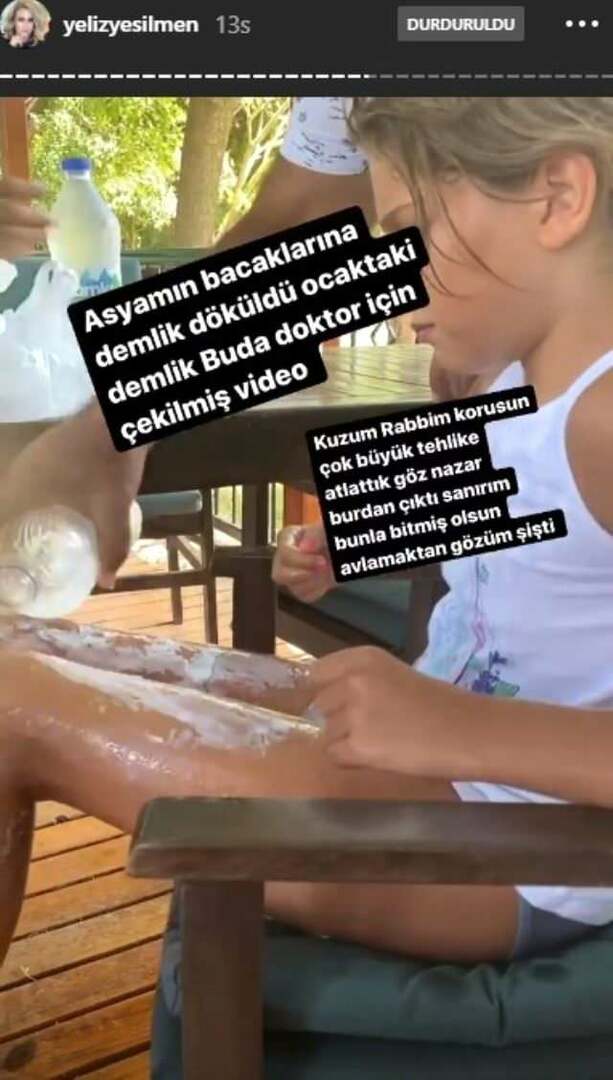 Forrásban lévő vizet öntöttek Yeliz Yeşilmen lánya lábaira
