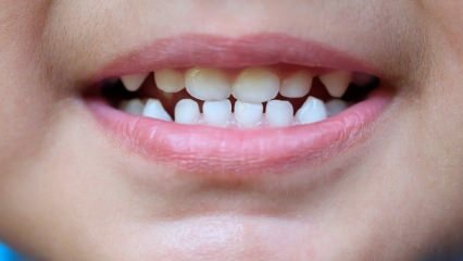 Hogyan tanítsuk meg a gyermekek fogászatát?