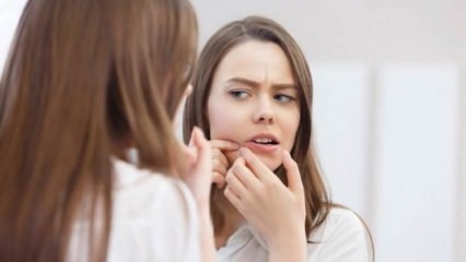 Mi okozza a pattanások az arcon?