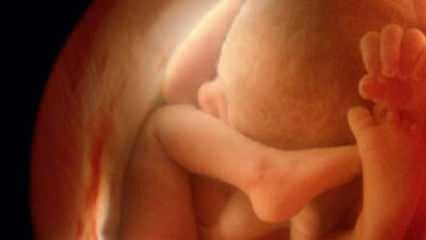 Nem mutatja meg a baba nemét ultrahangon! Hogyan néznek ki a kisfiúk és lányok az ultrahangon?