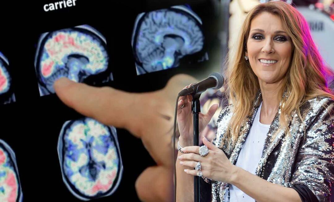 Mi az a merev személy szindróma? Mi Celine Dion betegsége?