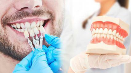 Miért hordják fel a cirkónium furnért a fogakra? Mennyire tartós a cirkónium bevonat?