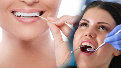 Hogyan őrizzük meg a száj és a fogak egészségét? Mit kell figyelembe venni fogtisztításkor?