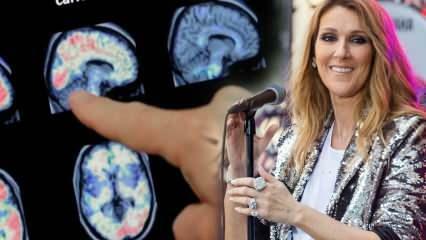 Mi az a merev személy szindróma? Celine Dion