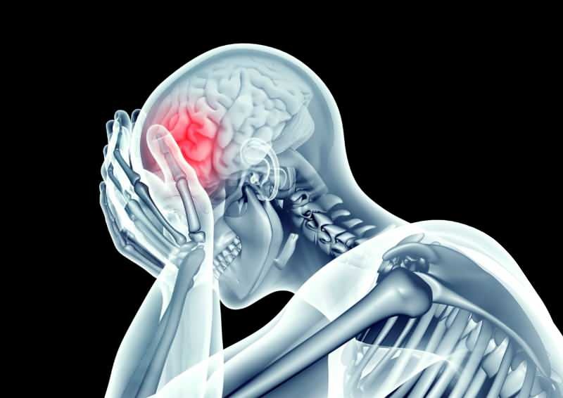 a croonavírus károsítja az agyat az erek szűkítésével