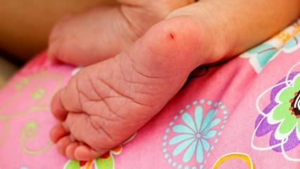 Miért veszik a sarokvért csecsemőknél? A csecsemők sarokvéreinek vizsgálatára vonatkozó követelmények