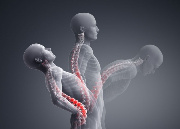 Mi a gerinc összeomlási törése? Hogyan kezelik a gerinc összeomlásának törését?
