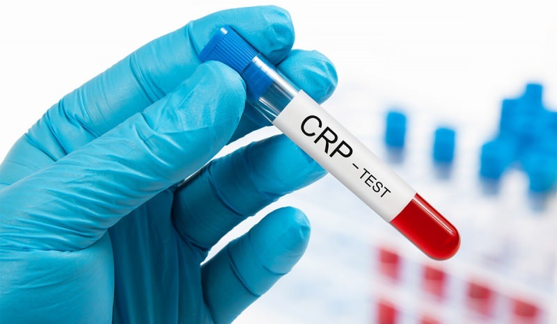 Miért emelkedik a vérben a CRP? Mi az a CRP? Hogyan csökkenthető a CRP?