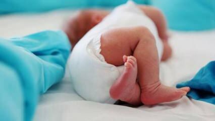Ha a csecsemőknek csípő ultrahanggal kell rendelkezniük?