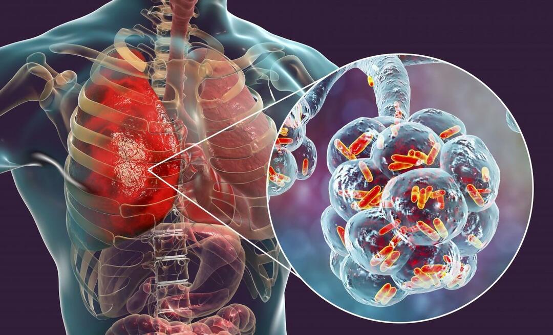 Mi a tüdőgyulladás és mik a tünetei? Hogyan kezelik az új járványos Pneumonia vírust?