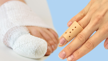 Mi okozza az ujj törését? Milyen tünetei vannak az ujj törésének?