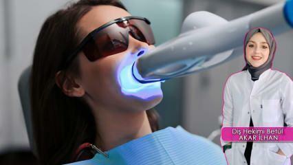 Hogyan történik a fogfehérítés (fehérítés) módszer? A fehérítési módszer károsítja a fogakat?