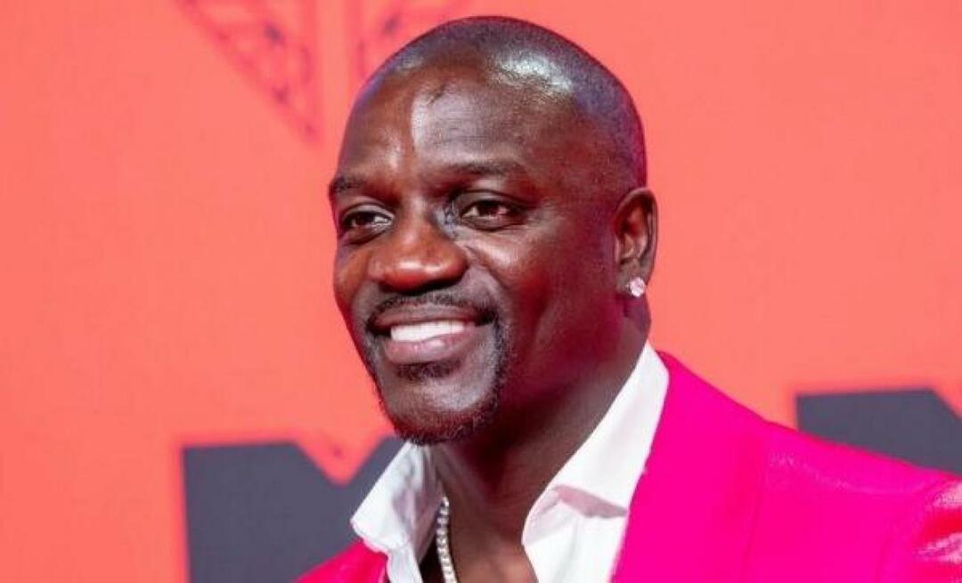 Az amerikai énekes, Akon is Törökországot részesítette előnyben a hajátültetésnél! Itt az ár, amit fizetett...
