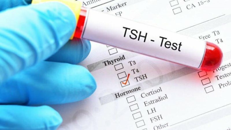A tsh teszt egy hormon teszt