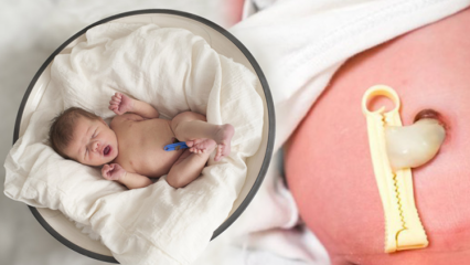 Mi az a Placenta Previa? Hogyan végezhető el köldökzsinór csecsemőknél? Ha a köldökzsinór hosszú ...
