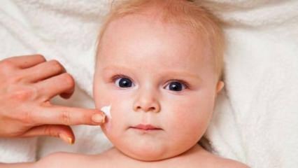 Bőrápolási tippek csecsemők számára! Melyek a bőrproblémák a csecsemőknél?