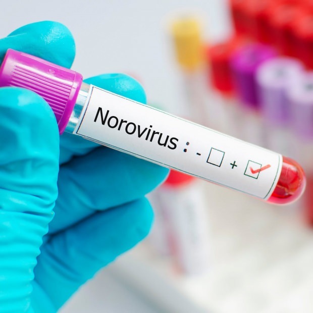 Mi a norovírus és milyen betegségeket okoz?