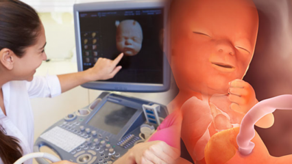 Melyik szerv alakul ki előbb csecsemőkben? Babafejlesztés hétről hétre