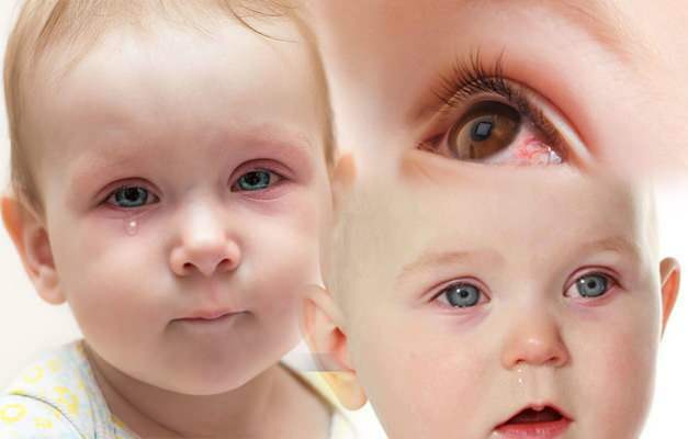 Miért kap vért a csecsemők szeme? Hogyan telik el a szem vérzése egy újszülöttnél?