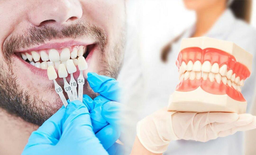 Miért helyeznek cirkónium koronát a fogakra? Mennyire tartós a cirkónium bevonat?