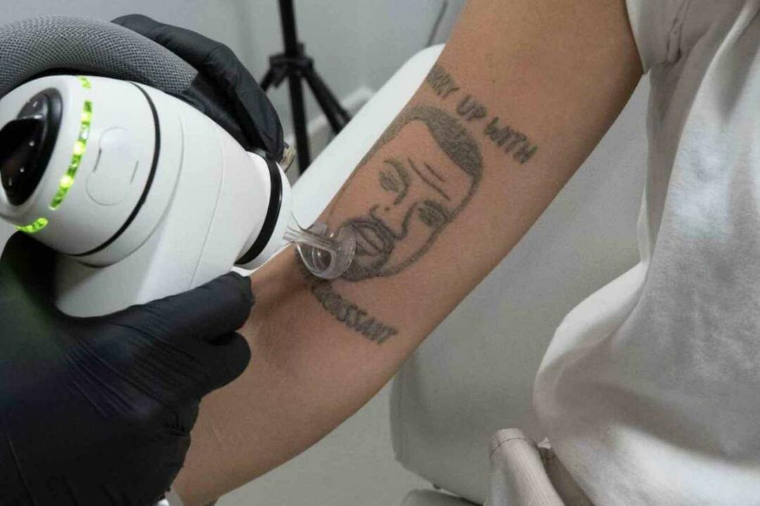 Ingyenesen távolítják el a Kanye West tetoválást Londonban 