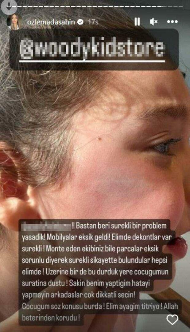 A gardrób ajtaja Berkay Şahin lányának arcára esett