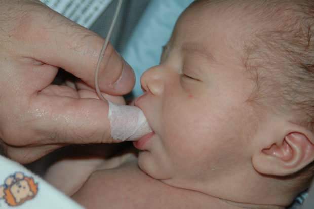Mi az ujjbeviteli módszer? Hogyan lehet etetni a babát fecskendővel?