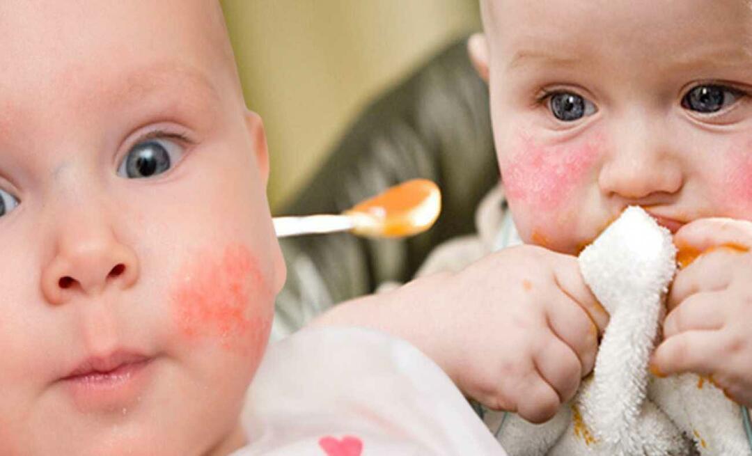 Mit egyen egy allergiás baba? Mik az alternatív ételek az allergiás babák számára?