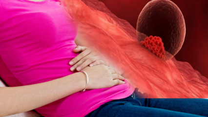 Mi az implantációs vérzés a terhesség alatt? Hogyan lehet megkülönböztetni az implantációs vérzést és a menstruációs vérzést